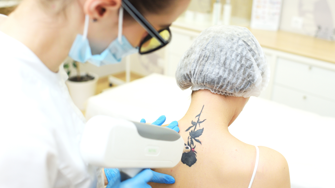 Permanent Tattoo Removal