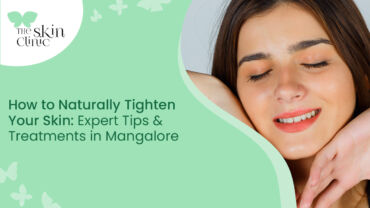 Skin Tightening Treatments in Mangalore