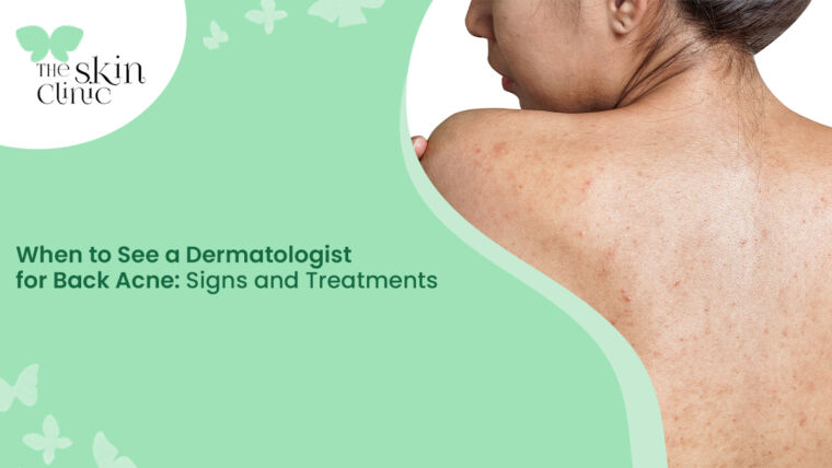 Dermatologist for Back Acne