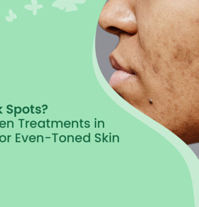 Dark Spots Treatment in Mangalore