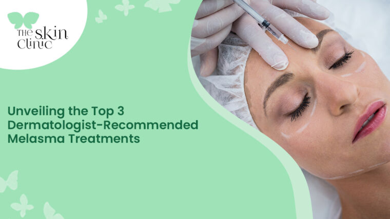Unveiling the Top 3 Dermatologist for Melasma Treatments in Mangalore
