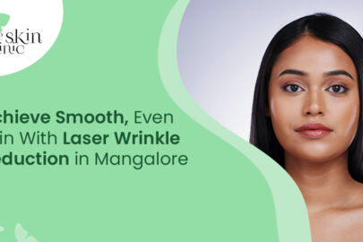 Laser Wrinkle Reduction in Mangalore