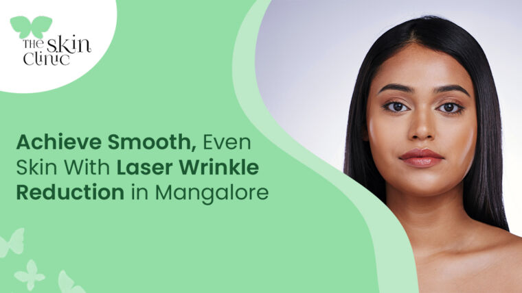 Laser Wrinkle Reduction in Mangalore