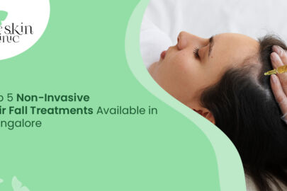 Non-Invasive Hair Fall Treatments in Mangalore