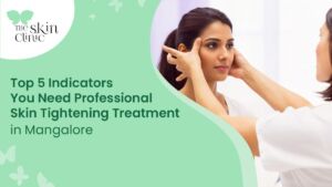Skin Tightening Treatment in Mangalore